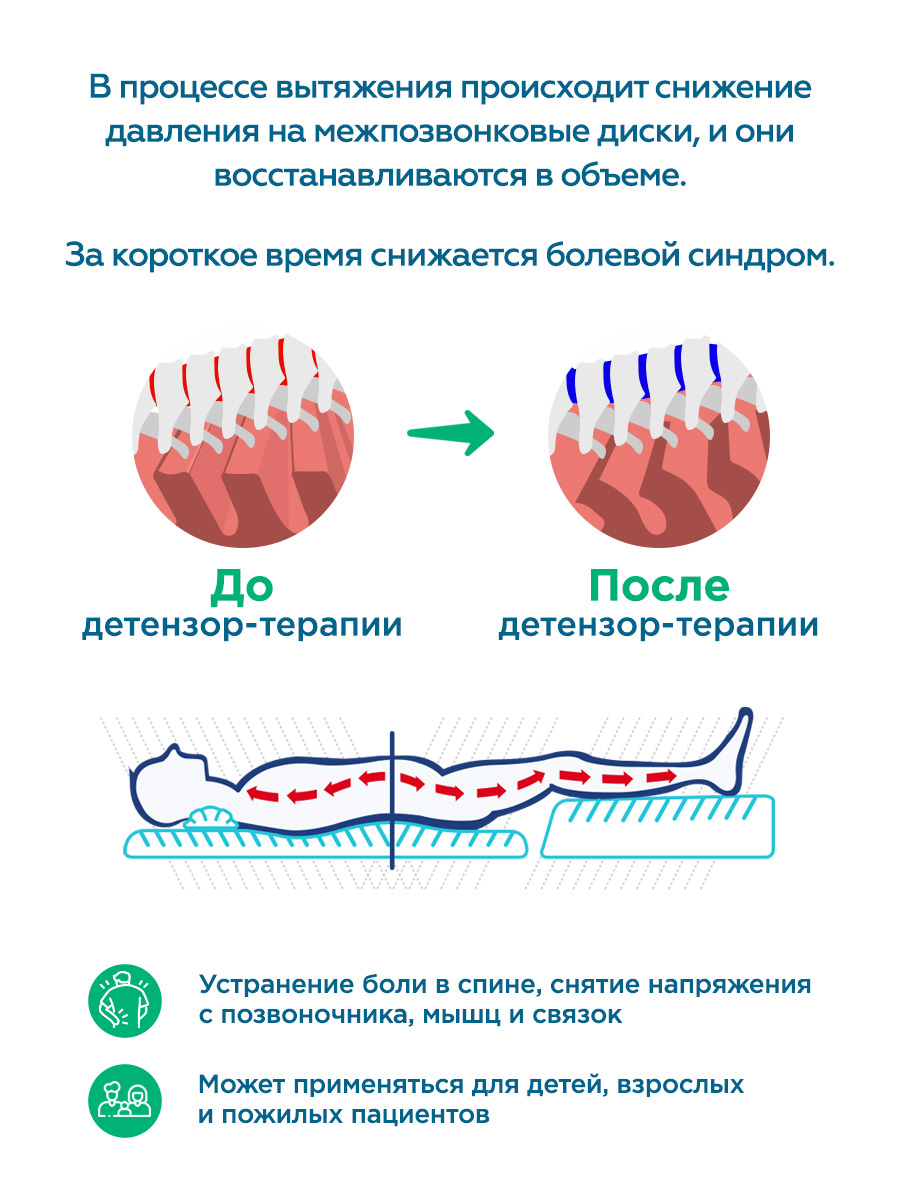 Детензор-терапия